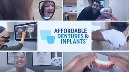 Dental Implants | Affordable Dentures & Implants